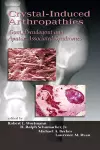 Crystal-Induced Arthropathies cover