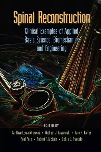 Spinal Reconstruction cover