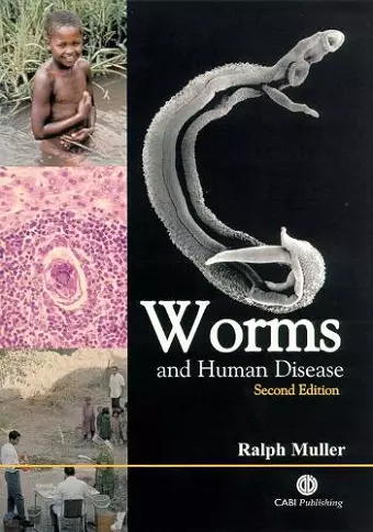 Worms and Human Disease cover