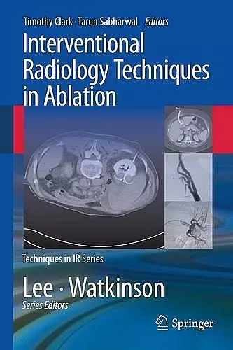 Interventional Radiology Techniques in Ablation cover