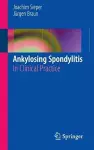 Ankylosing Spondylitis cover