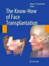 The Know-How of Face Transplantation cover