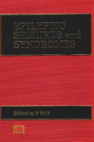 Epileptic Seizures & Syndromes cover