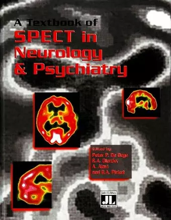 Textbook of SPECT in Neurology & Psychiatry cover