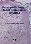 Neuropathology of Focal Epilepsies cover