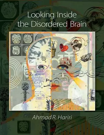 Looking Inside the Disordered Brain cover