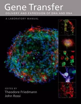 Gene Transfer cover