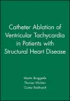 Catheter Ablation of Ventricular Tachycardia in Patients with Structural Heart Disease cover