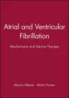 Atrial and Ventricular Fibrillation cover