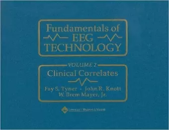 Fundamentals of EEG Technology cover