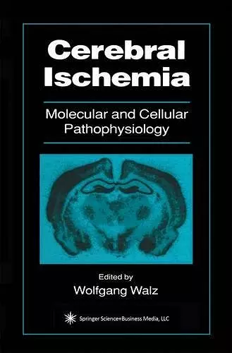 Cerebral Ischemia cover