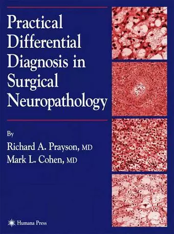 Practical Differential Diagnosis in Surgical Neuropathology cover