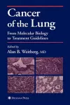 Cancer of the Lung cover