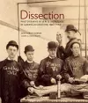 Dissection cover