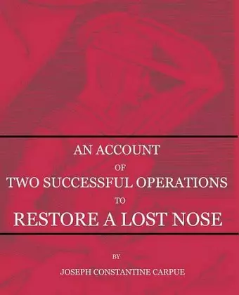 An Account of Two Successful Operations for Restoring a Lost Nose cover