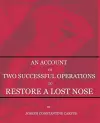 An Account of Two Successful Operations for Restoring a Lost Nose cover