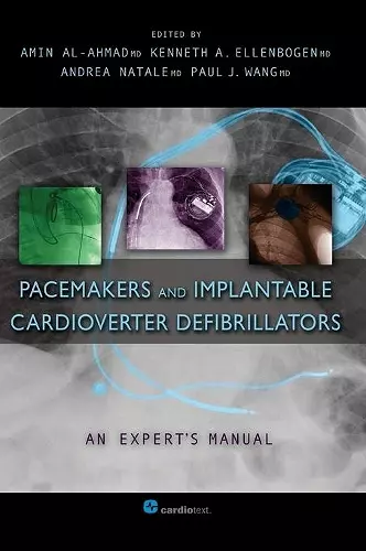 Pacemakers and Implantable Cardioverter Defibrillators cover