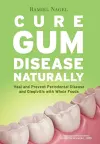 Cure Gum Disease Naturally cover