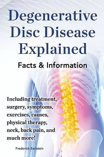 Degenerative Disc Disease Explained. Including treatment, surgery, symptoms, exercises, causes, physical therapy, neck, back, pain, and much more! Facts & Information cover