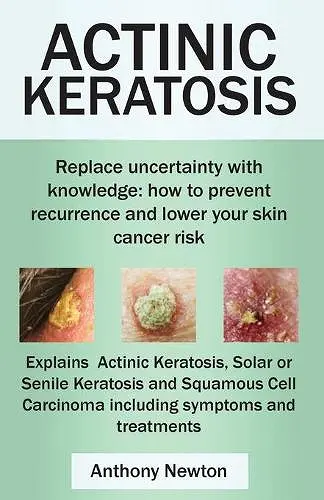Actinic Keratosis cover