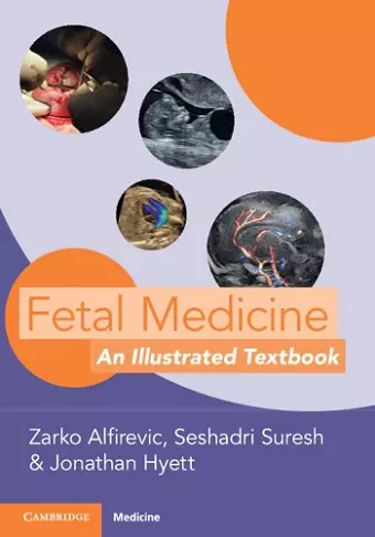 Fetal Medicine cover