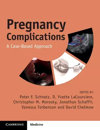 Pregnancy Complications cover