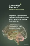 Ruptured Supratentorial Cerebral Artery Aneurysm with Large Intracerebral Haematoma cover