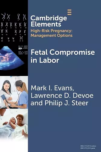 Fetal Compromise in Labor cover