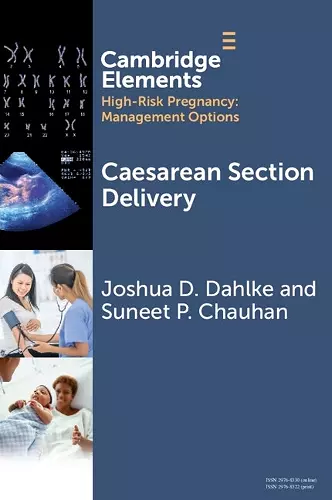 Caesarean Section Delivery cover