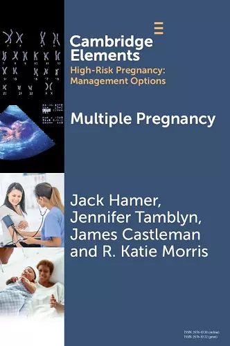 Multiple Pregnancy cover