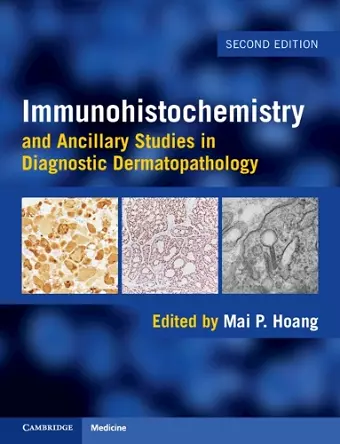 Immunohistochemistry and Ancillary Studies in Diagnostic Dermatopathology cover