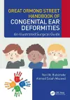 Great Ormond Street Handbook of Congenital Ear ‎Deformities cover