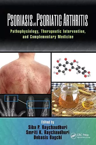 Psoriasis and Psoriatic Arthritis cover