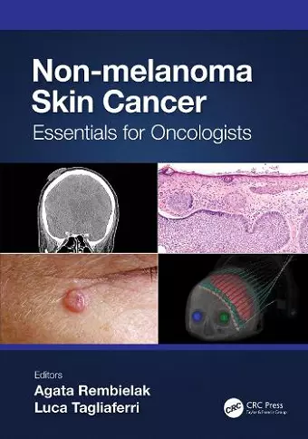 Non-melanoma Skin Cancer cover