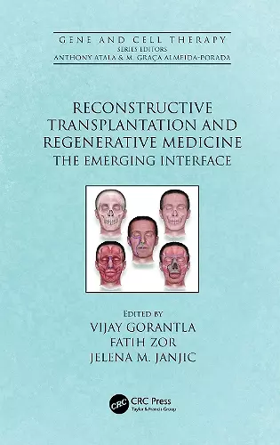 Reconstructive Transplantation and Regenerative Medicine cover