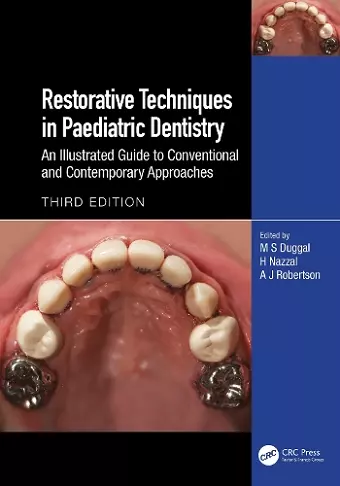 Restorative Techniques in Paediatric Dentistry cover