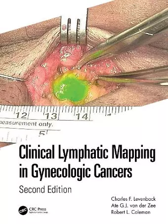 Clinical Lymphatic Mapping in Gynecologic Cancers cover