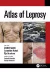 Atlas of Leprosy cover