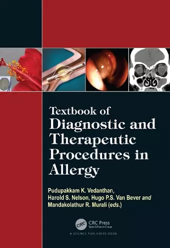 Textbook of Diagnostic and Therapeutic Procedures in Allergy cover