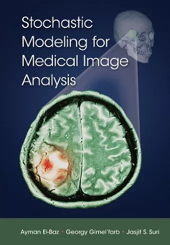 Stochastic Modeling for Medical Image Analysis cover