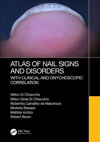 Atlas of Nail Signs and Disorders with Clinical and Onychoscopic Correlation cover