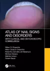 Atlas of Nail Signs and Disorders with Clinical and Onychoscopic Correlation cover