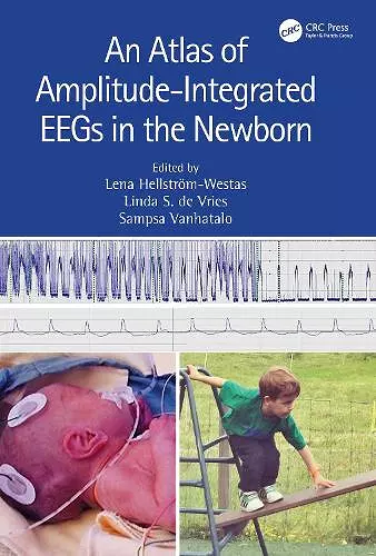 An Atlas of Amplitude-Integrated EEGs in the Newborn cover