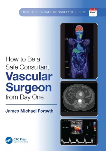 How to be a Safe Consultant Vascular Surgeon from Day One cover