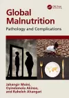 Global Malnutrition cover