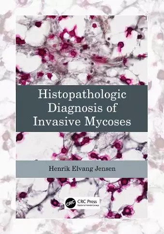 Histopathologic Diagnosis of Invasive Mycoses cover