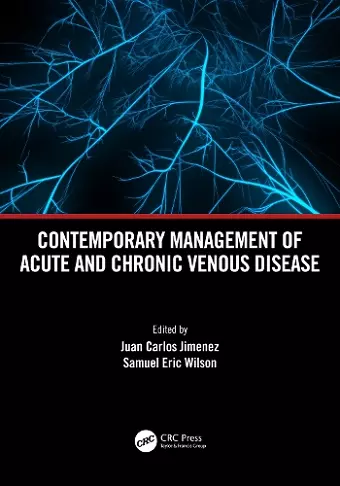 Contemporary Management of Acute and Chronic Venous Disease cover