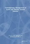 Contemporary Management of Acute and Chronic Venous Disease cover