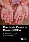 Paediatric Cases in Coloured Skin cover