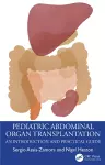 Pediatric Abdominal Organ Transplantation cover